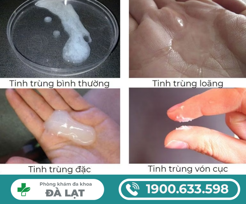 Hình ảnh minh họa